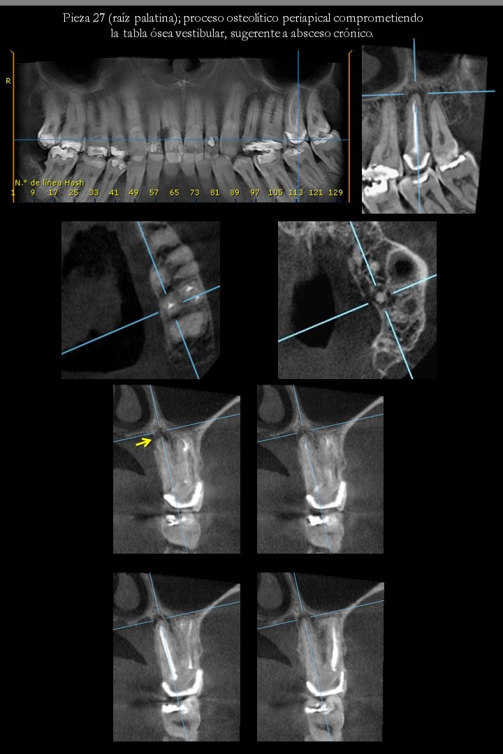 diapositiva2